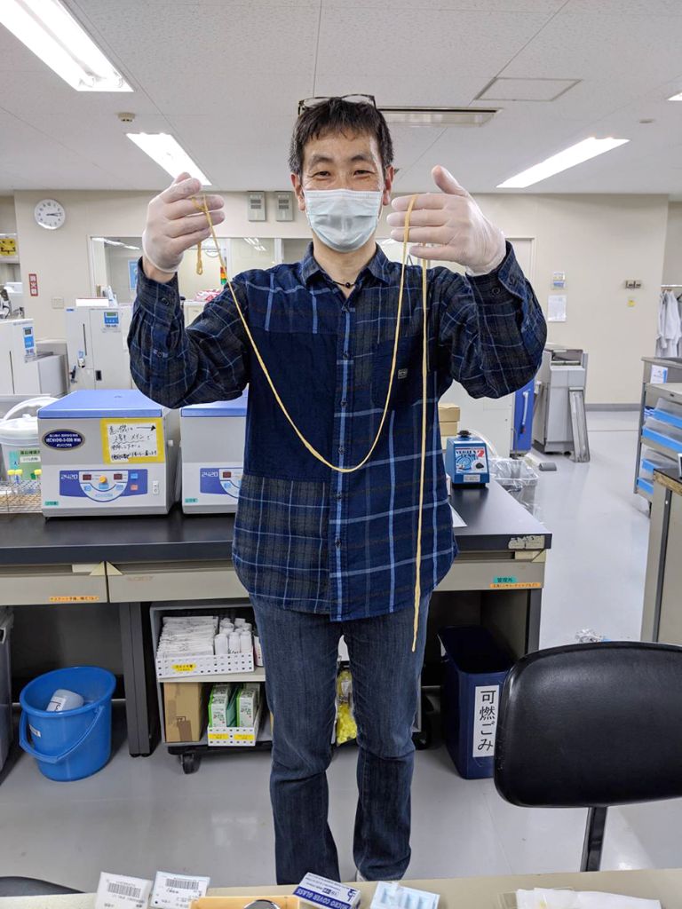 患者の糞便から見つかった日本海裂頭条虫に感激