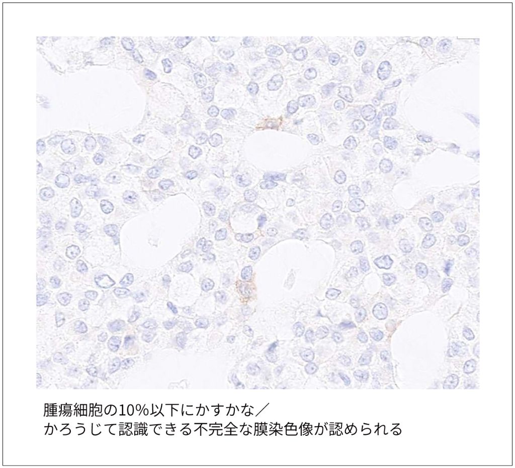 図3　超低発現（ultralow）の染色像例