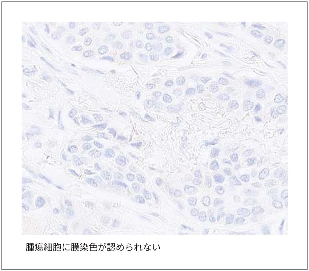 図2　無発現（null）の染色像例