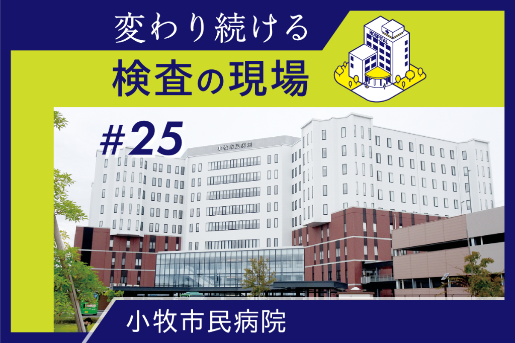 外来での使用実態を把握、血糖測定器を一元管理　装置点検「提出・交換方式」に