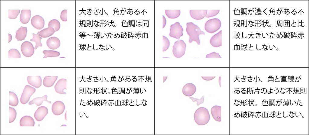 類似しているが破砕赤血球としない形状（カテゴリーB）