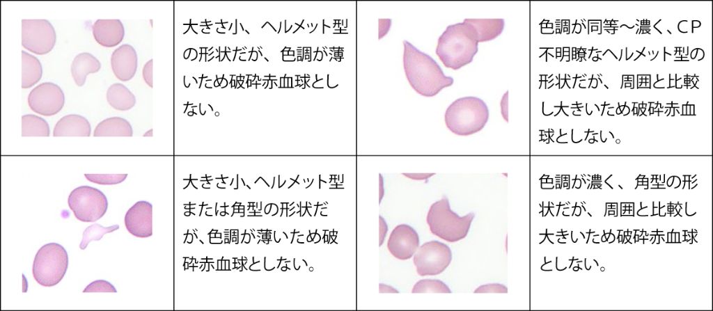 類似しているが破砕赤血球としない形状（カテゴリーA）