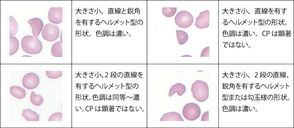 カテゴリーA（典型的な形状）の一部