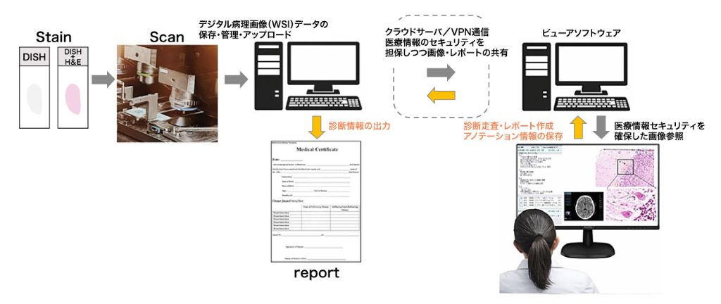 日本の医療現場におけるデジタルパソロジー診断フローの一例