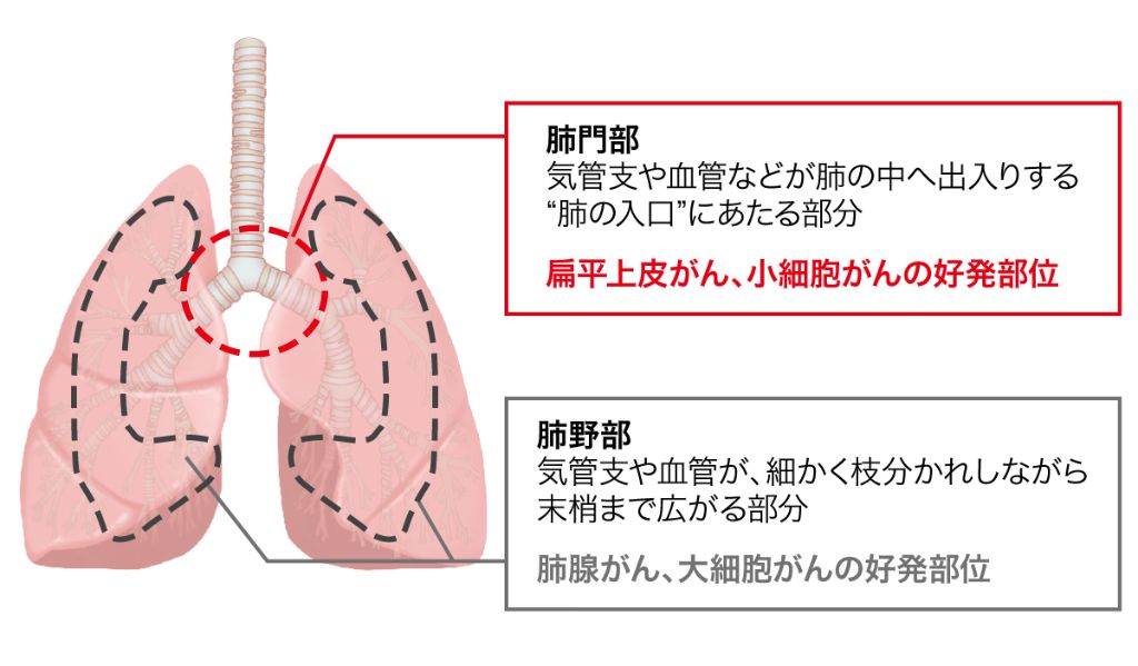 臨床家のための肺血管病理生理検診 臨床・画像・病理を通して理解できる！～呼吸器疾患：Clinical