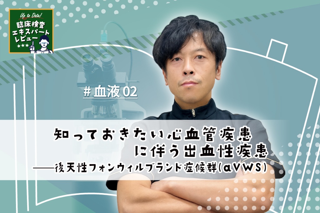 知っておきたい心血管疾患に伴う出血性疾患——後天性フォンウィルブランド症候群(aVWS)