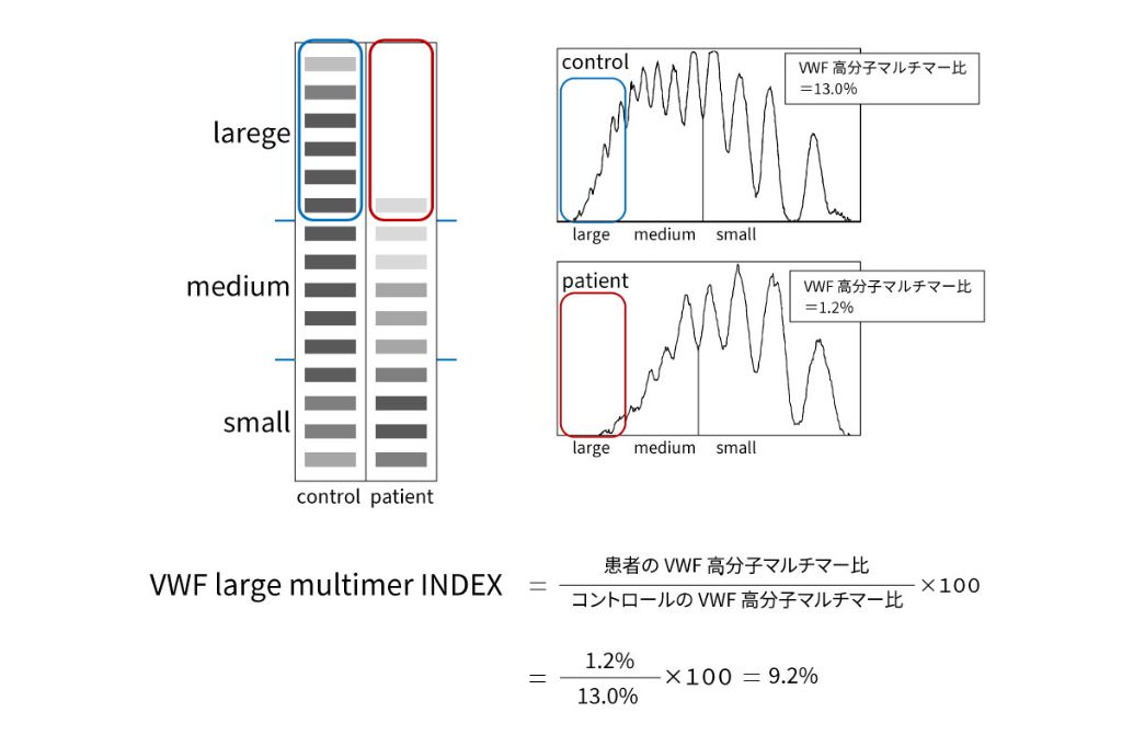 図2．VWFマルチマー解析：VWF large multimer INDEX 文献8)を参考に作成