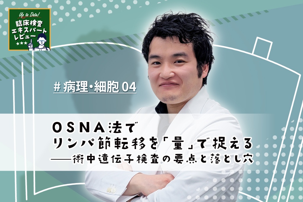 OSNA法でリンパ節転移を「量」で捉える——術中遺伝子検査の要点と落とし穴