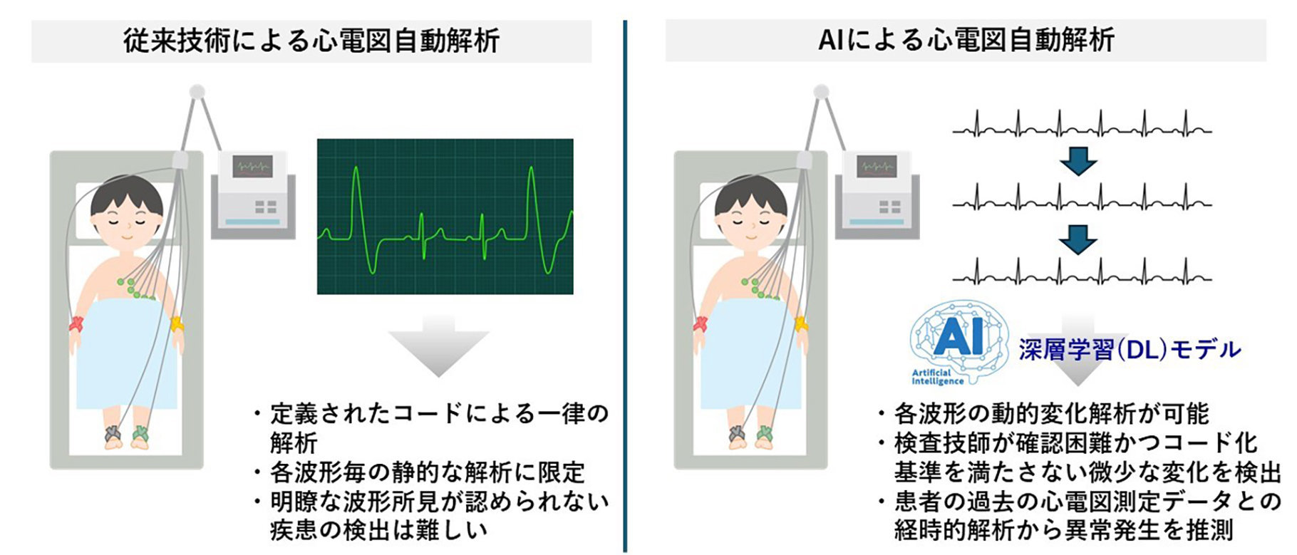 図1：心電図検査におけるAI利用