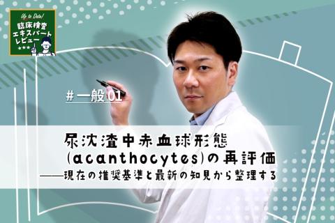 尿沈渣中赤血球形態（acanthocytes）の再評価——現在の推奨基準と最新の知見から整理する