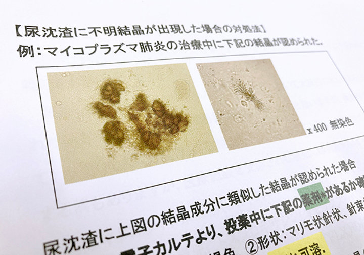 マイコプラズマ肺炎流行「尿沈渣に注意を」