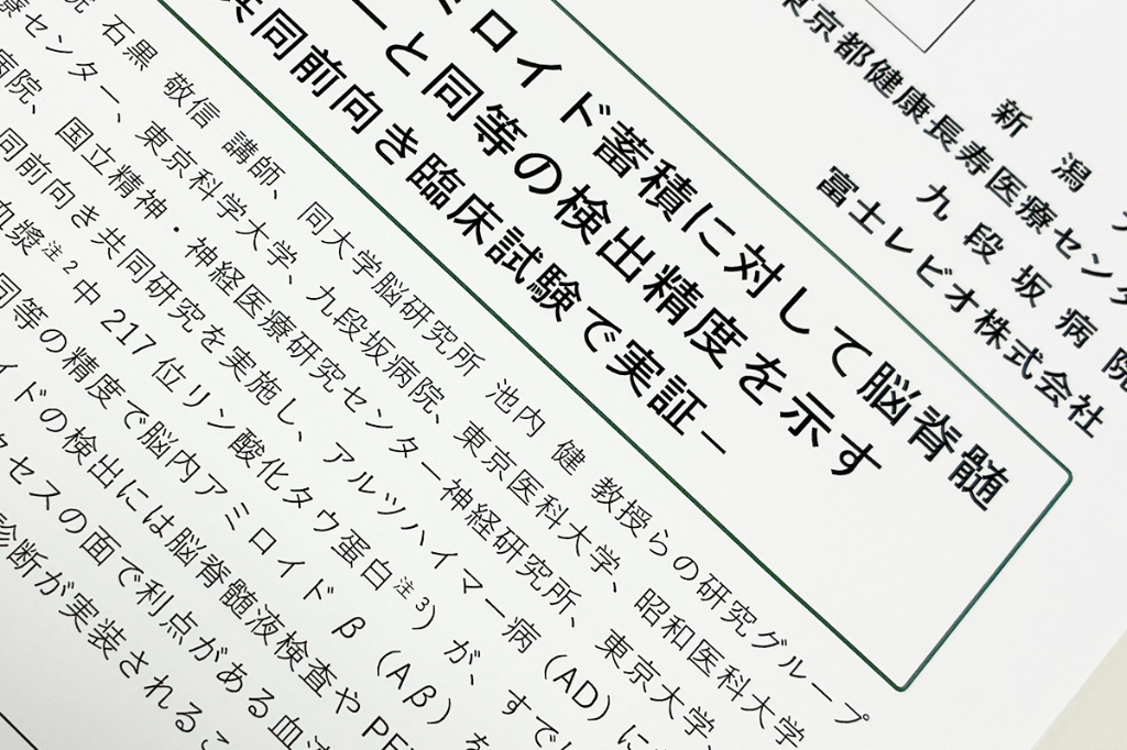血漿p-tau217、脳脊髄液と同等の精度でAβ検出