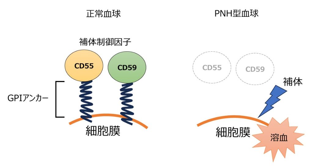 図1　正常血球とPNH型血球のイメージ図