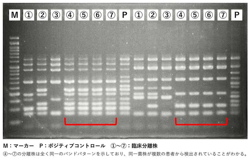 図2　POT法を用いた菌株解析