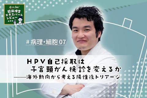 HPV自己採取は子宮頸がん検診を変えるか——海外動向から考える陽性後トリアージ