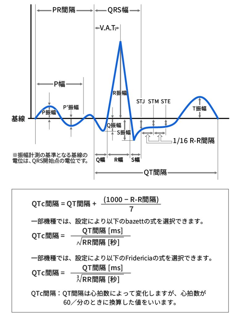 図1　波形と計測値の対応 〔日本光電工業株式会社より提供〕