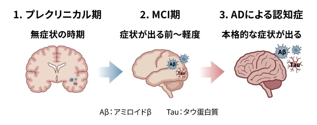 図　アルツハイマー病連続体（Alzheimer’s disease continuum）