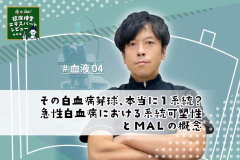 その白血病芽球、本当に1系統？ 急性白血病における系統可塑性とMALの概念