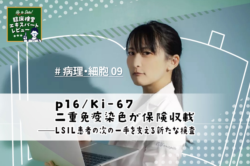 p16/Ki-67二重免疫染色が保険収載——LSIL患者の次の一手を支える新たな検査