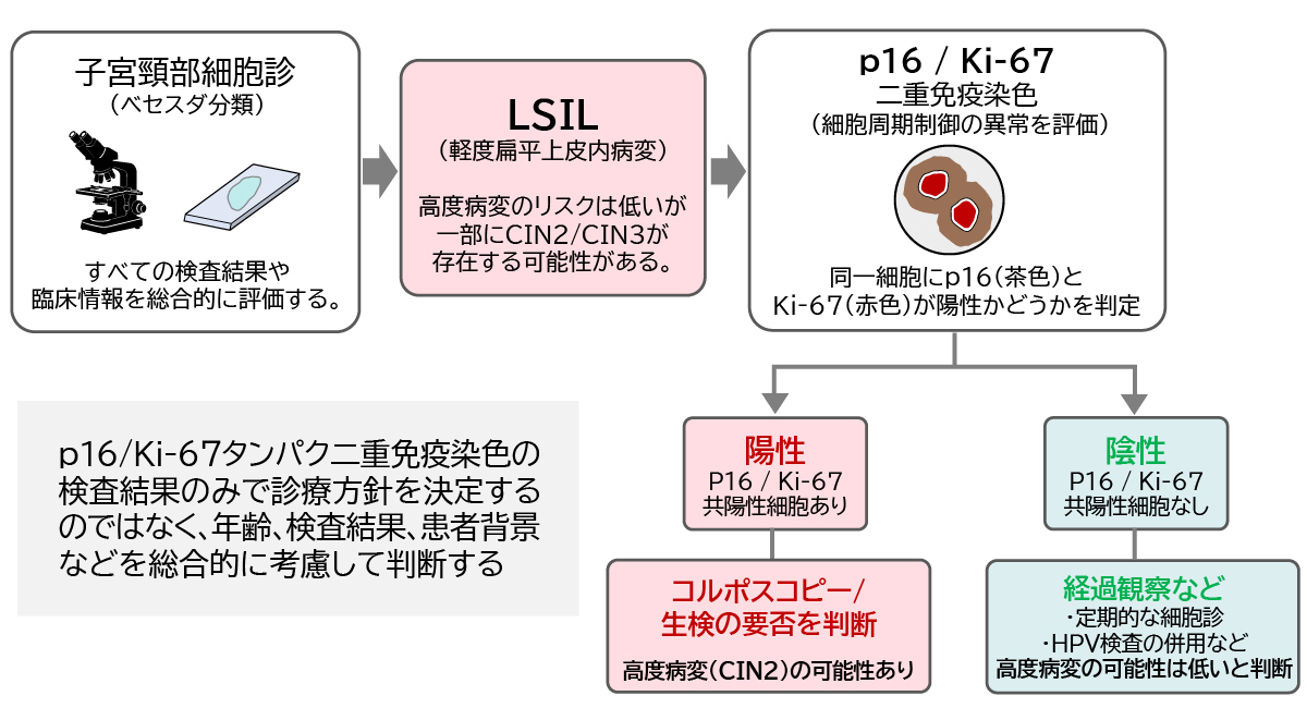 図1　p16Ki-67タンパク二重免疫染色を用いた軽度扁平上皮内病変患者のトリアージ
