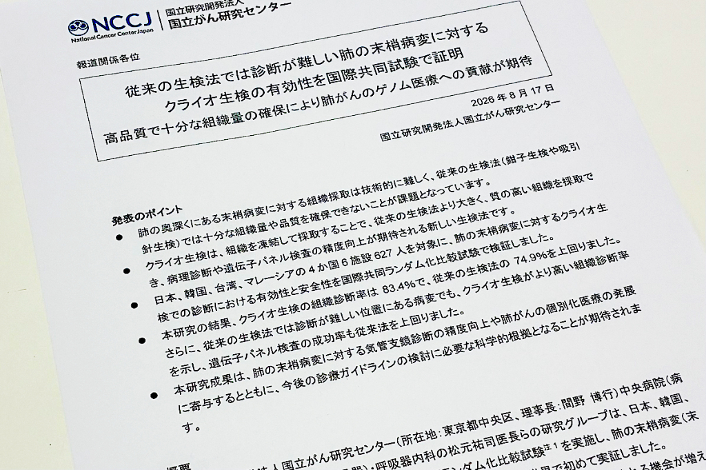 末梢肺病変、クライオ生検で診断率向上