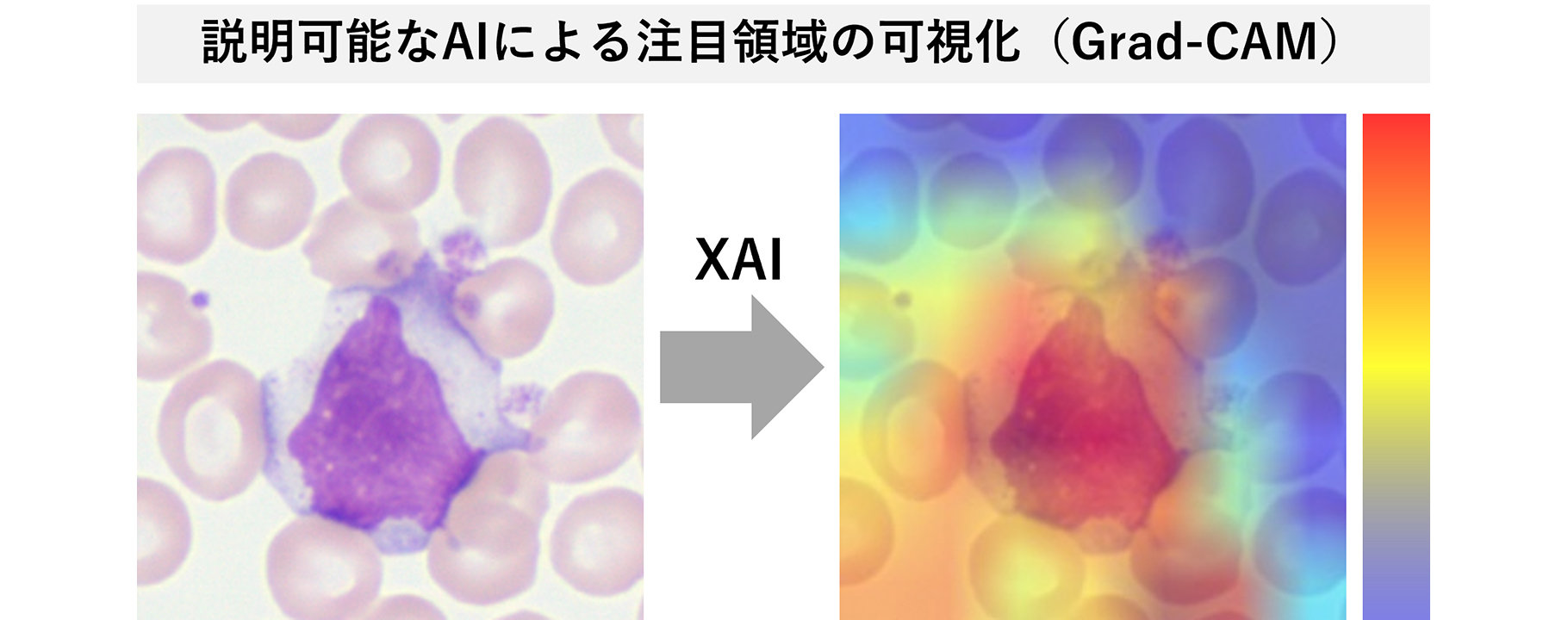 図2：説明可能なAI（XAI）によって血球分類の判断根拠となる注目領域を可視化させた例
