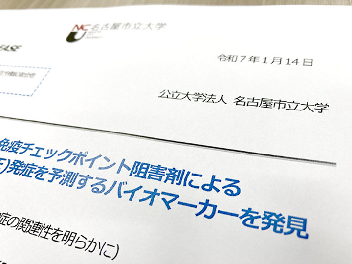 重症irAEを予測するバイオマーカーを発見　名市大などグループ