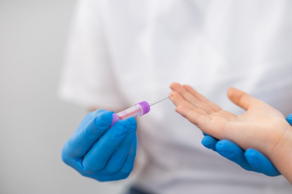 Microvette微量採血管